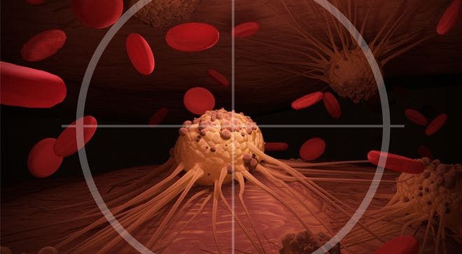 Novel Agents May Lead to a Chemo-Free Future for Patients With Mantle Cell Lymphoma