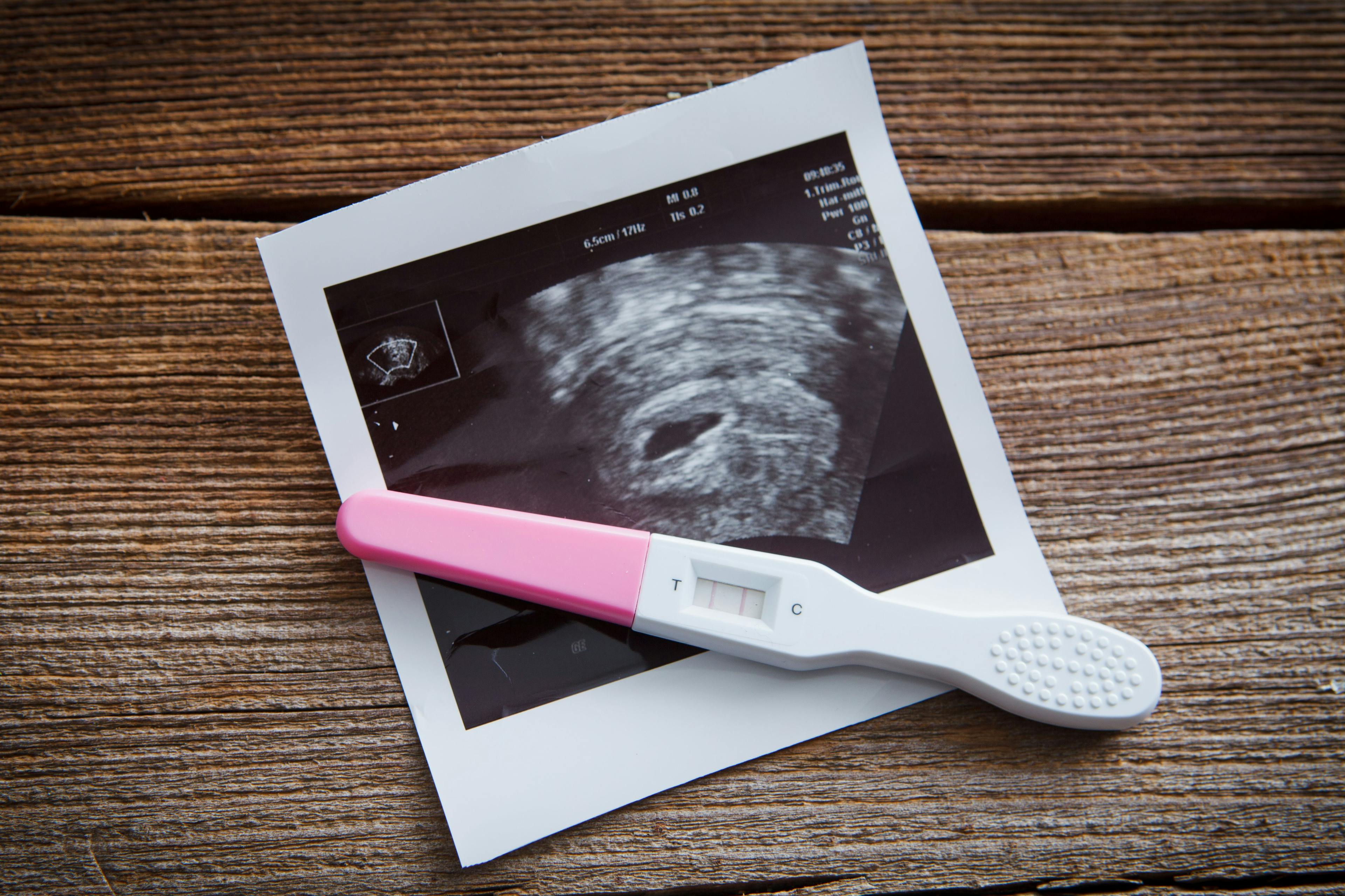 Image of a sonogram and a positive pregnancy test on a wooden surface.