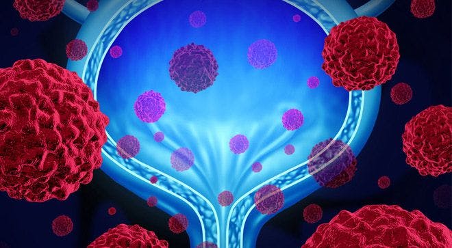 Newly Approved Targeted Therapy Paves the Way for Patients With Advanced Bladder Cancer