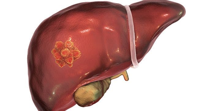 5 Liver Cancer News and Updates That Patients May Have Missed in 2020